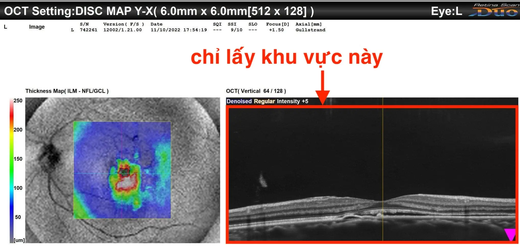 Hướng dẫn cắt ảnh